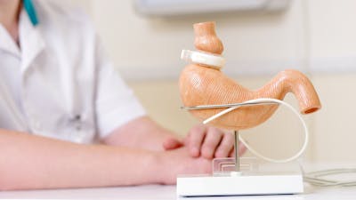 Bariatric surgery for metabolic health and weight loss