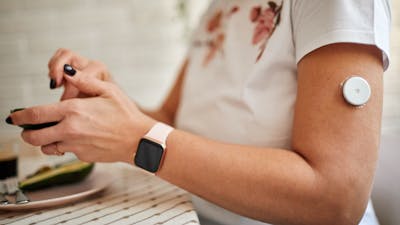What is a CGM — and is it right for you?