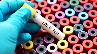 Is elevated LDL cholesterol harmful?